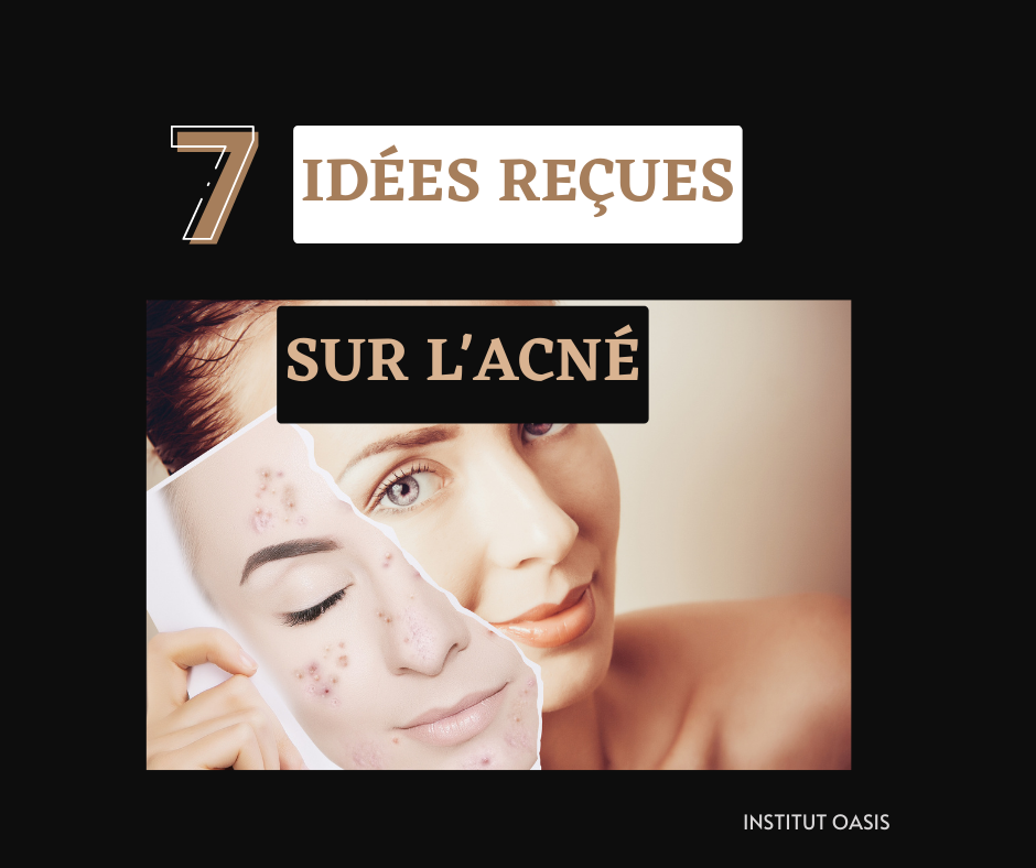 7 idées reçues sur l'acné - Institut Oasis / Trescan Annie